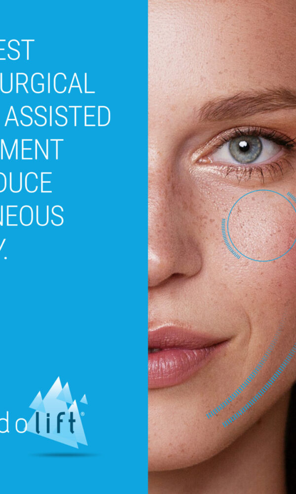 اندولیفت (Endolift) چیست و چگونه صورت را لیفت میکند؟