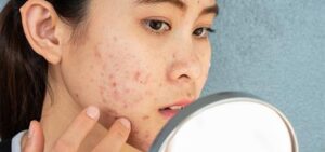 مراقبت از پوست توصیه شده توسط متخصصین پوست برای 20 سالگی