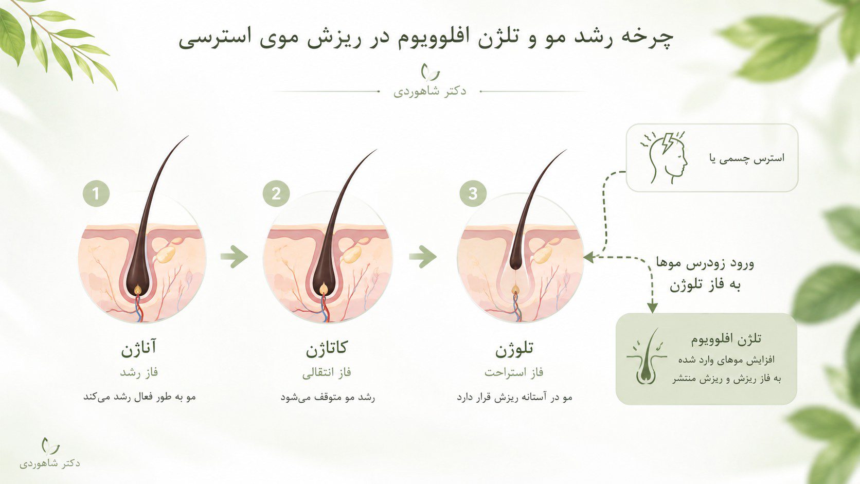 چرخه رشد مو و تلژن افلوویوم در ریزش موی استرسی - دکتر شاهوردی