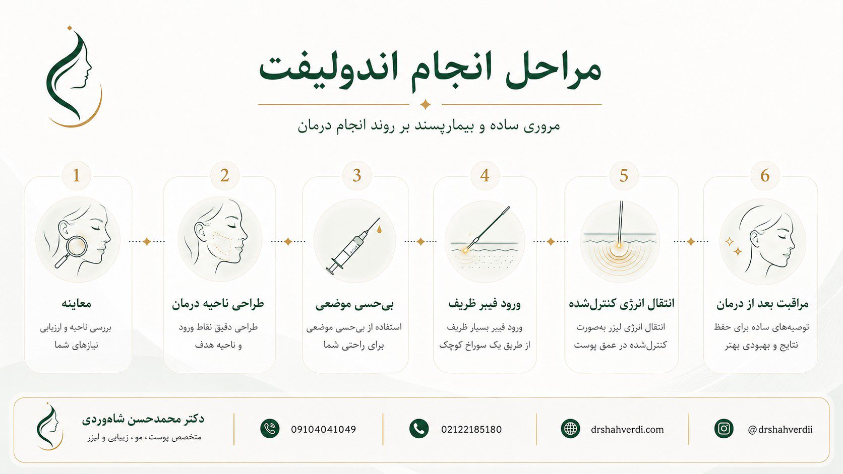 مراحل انجام اندولیفت صورت غبغب و خط فک