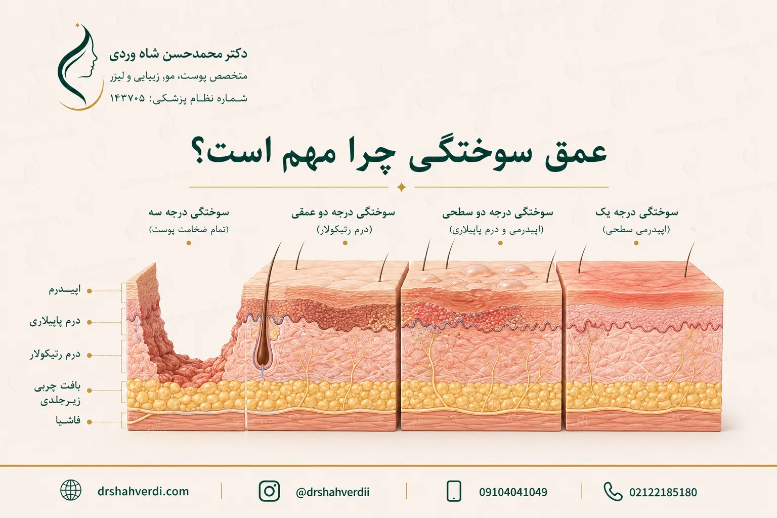 تفاوت عمق سوختگی در لایه‌های اپیدرم و درم پوست