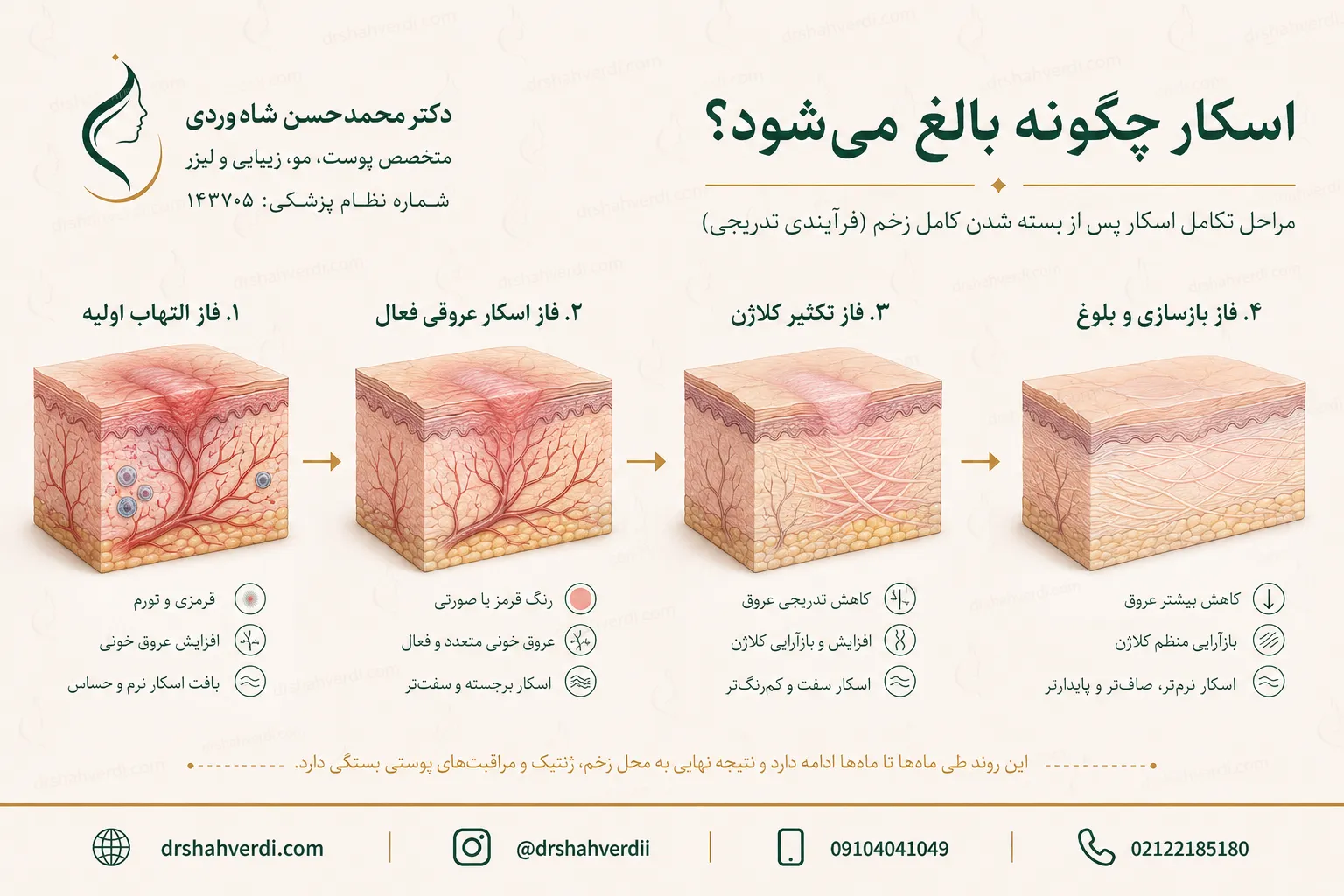 مراحل التهاب تکثیر کلاژن و بلوغ اسکار سوختگی