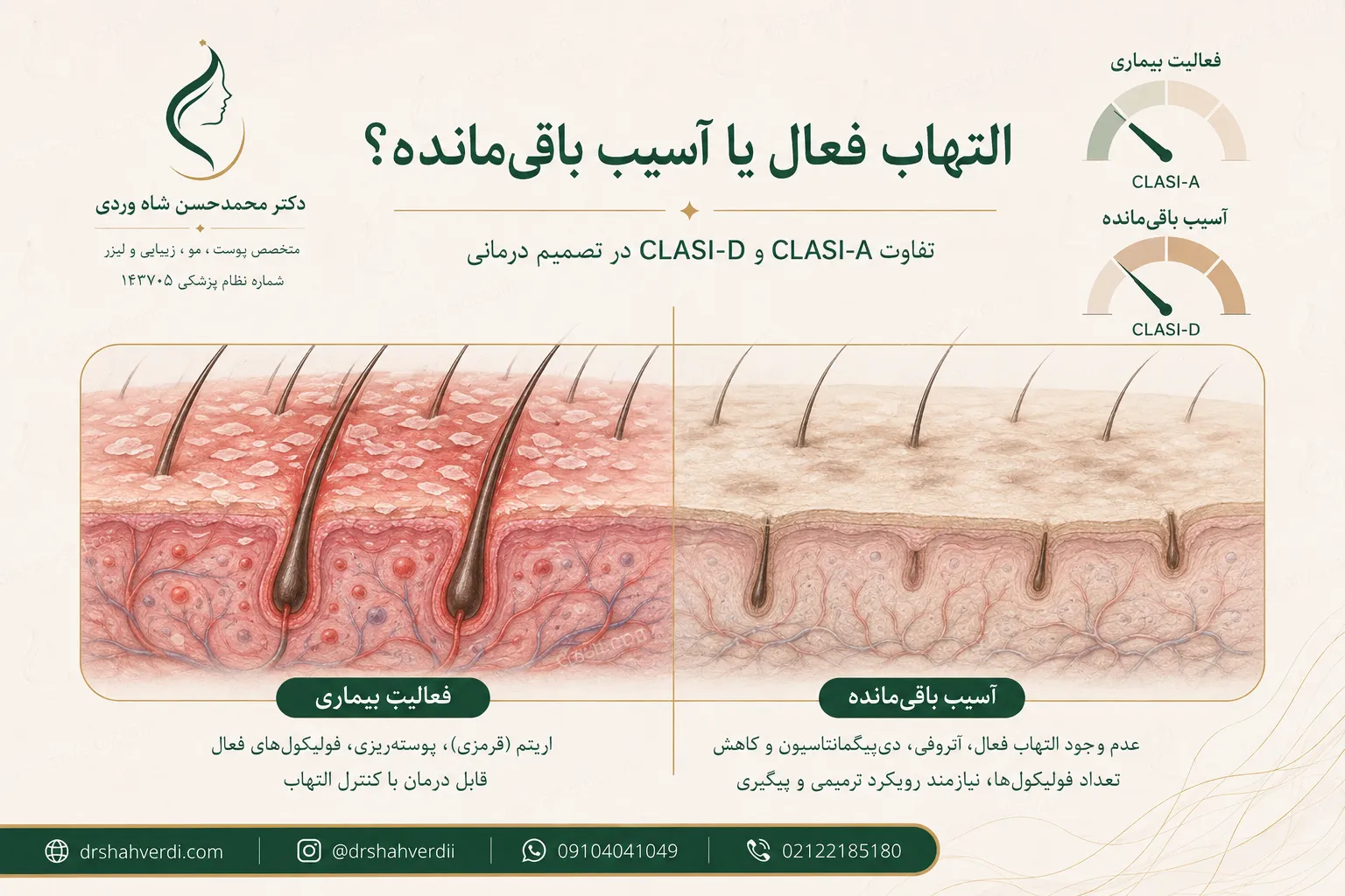تفاوت فعالیت لوپوس پوستی با اسکار و تغییر رنگ باقی مانده