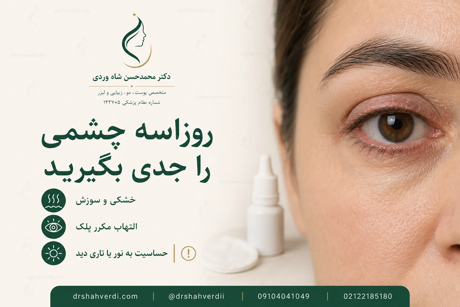 علائم روزاسه چشمی شامل خشکی، التهاب پلک، درد و حساسیت به نور