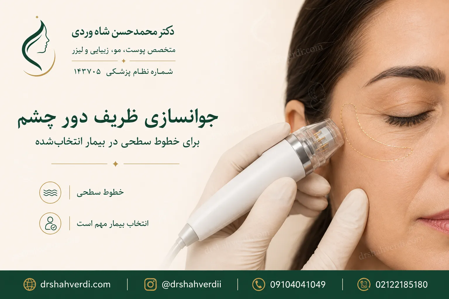 جوانسازی خطوط ظریف دور چشم با آر اف ترمیا