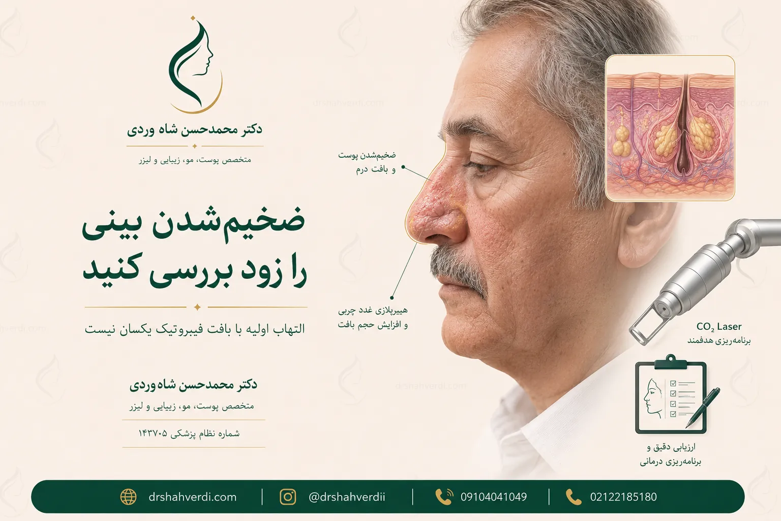 روزاسه فیماتوز و بررسی درمان رینوفیما با لیزر CO2 یا جراحی