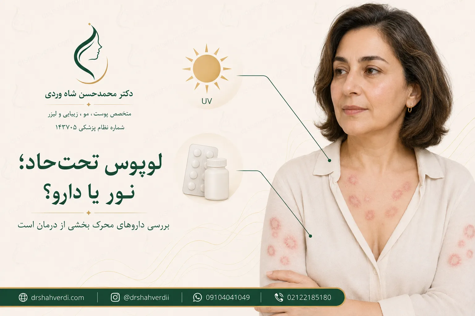 لوپوس پوستی تحت حاد و نقش نور خورشید و داروهای محرک