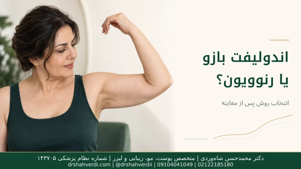 تصویر مقاله اندولیفت بازو؛ کاربرد، نتیجه و مقایسه روشهای رفع افتادگی