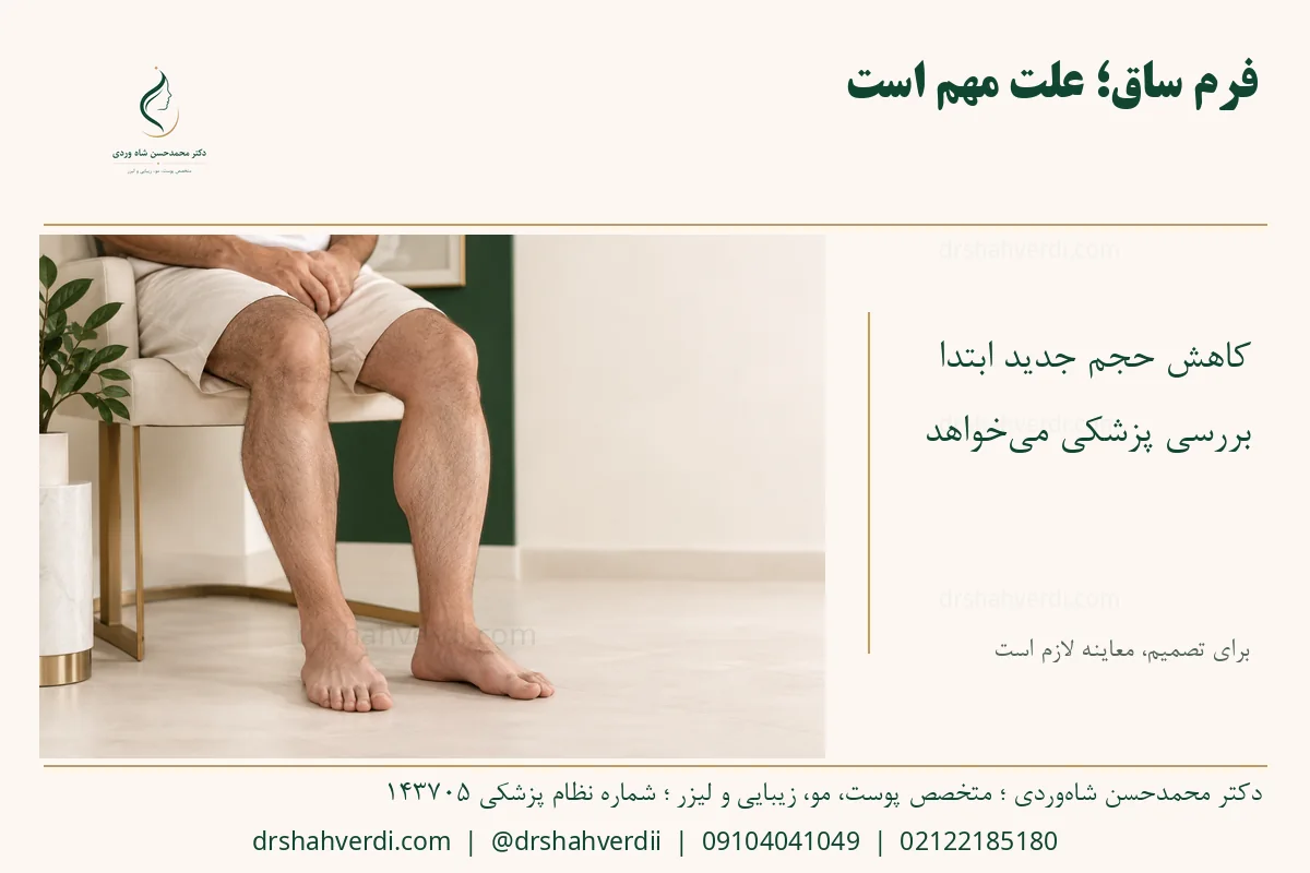 نمای ساق‌های یک فرد بزرگسال برای توضیح تفاوت حجم عضله و بافت نرم