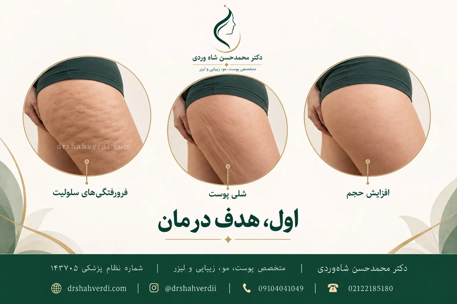 سه نمای ران برای مقایسهٔ فرورفتگیهای سلولیت، شلی پوست و افزایش حجم