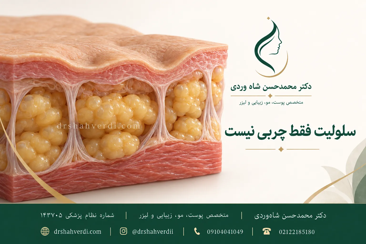 مدل مقطعی پوست با فرورفتگی سطح، چربی زیرپوستی و رشتههای فیبری متصل به پوست