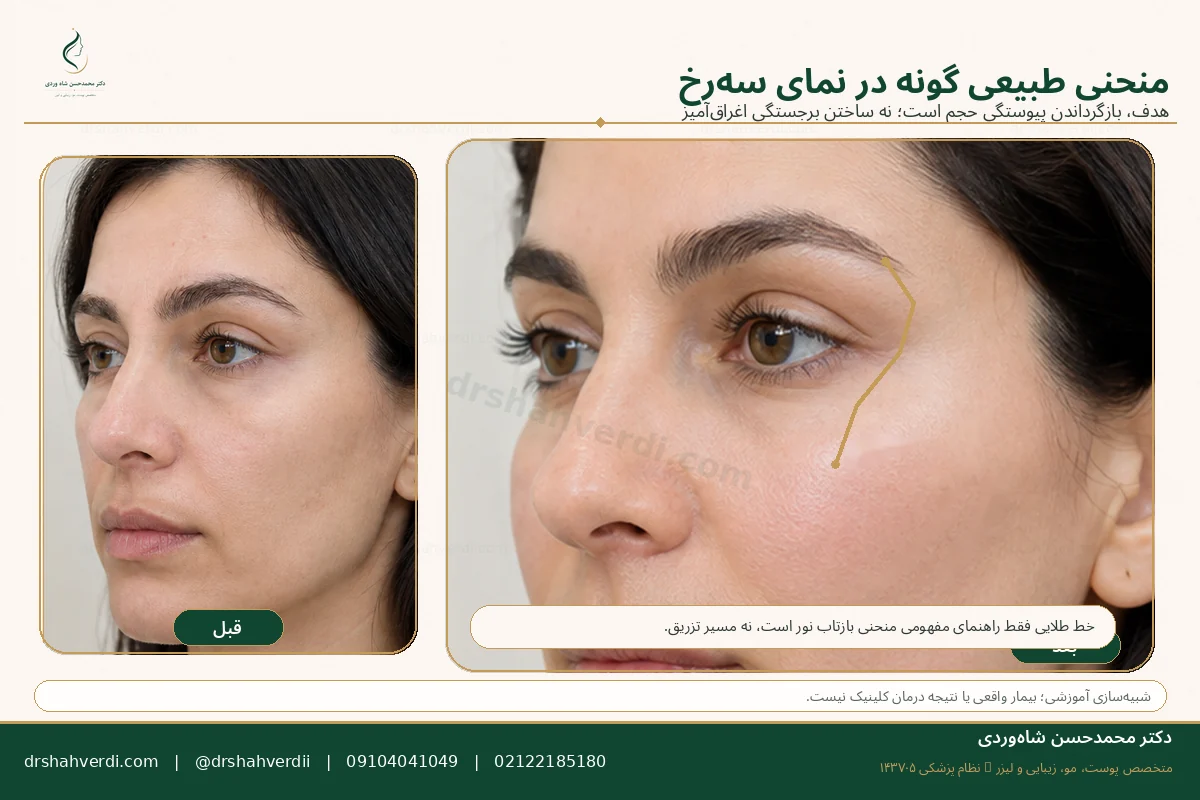 شبیه‌سازی آموزشی منحنی طبیعی گونه و میدفیس در نیمرخ