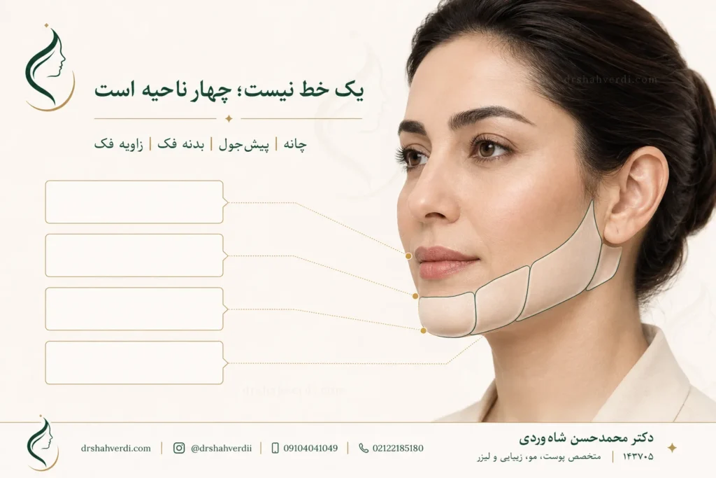 تفکیک نواحی چانه، پیشجول، بدنه فک و زاویه فک در طراحی فیلر پایین صورت