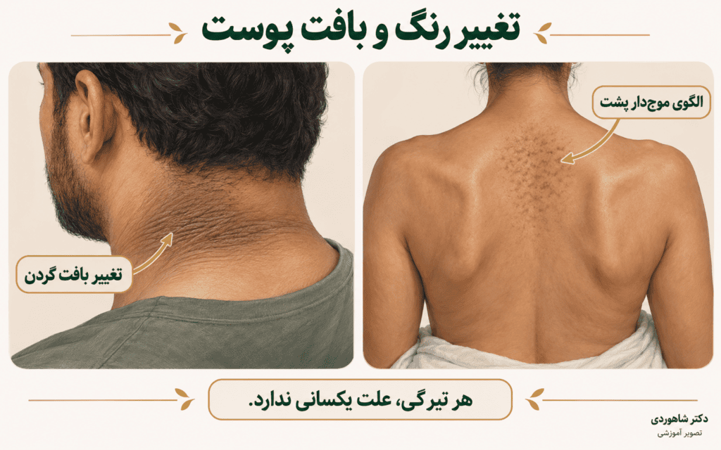 تصویر مقاله تیرگی و تغییر رنگ پوست بدن؛ علت مهم‌تر از رنگ است