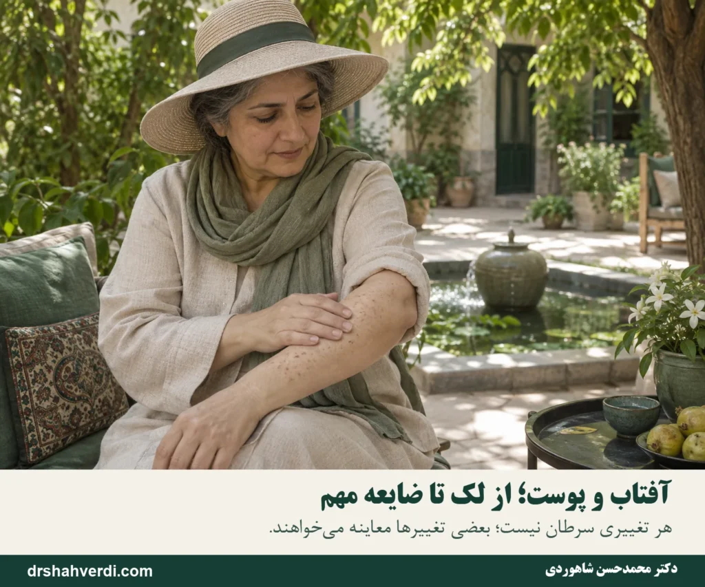 تصویر مقاله ضایعات پوستی ناشی از آفتاب؛ از لک آفتابی تا علائم سرطان پوست