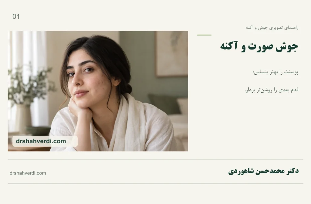 تصویر مقاله جوش صورت و آکنه؛ انواع، علت‌ها، درمان و راهنمای مراجعه