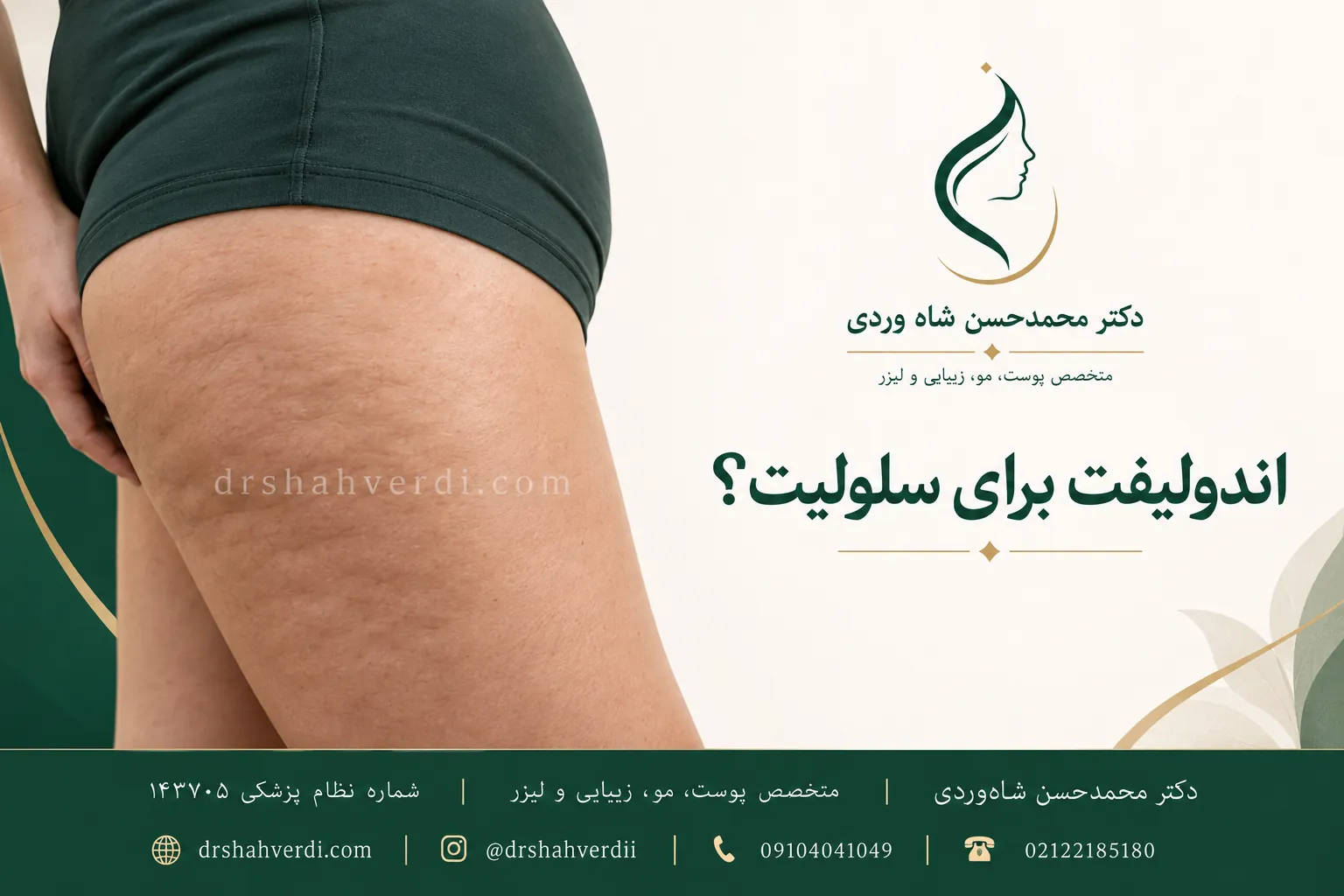نمای پوست ران با فرورفتگیهای سلولیت در کنار عنوان اندولیفت برای سلولیت