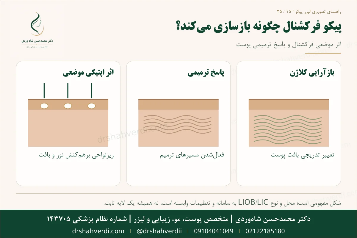 LIOB و بازسازی کلاژن با پیکو فرکشنال