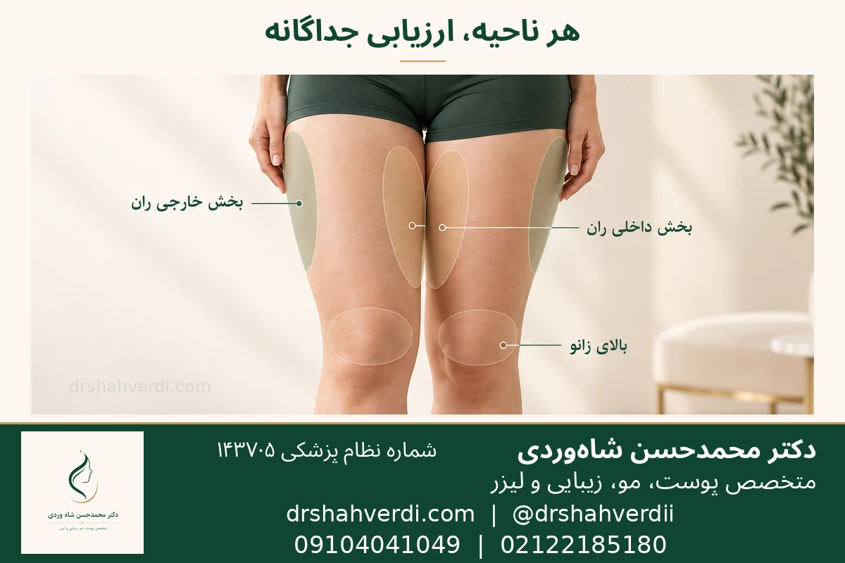 تفکیک داخل ران، خارج ران و بالای زانو در ارزیابی ناحیه