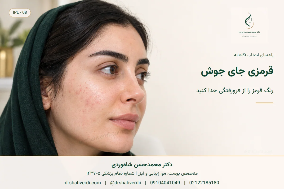 لکه‌های قرمز آموزشی روی گونه در بحث قرمزی بعد از جوش