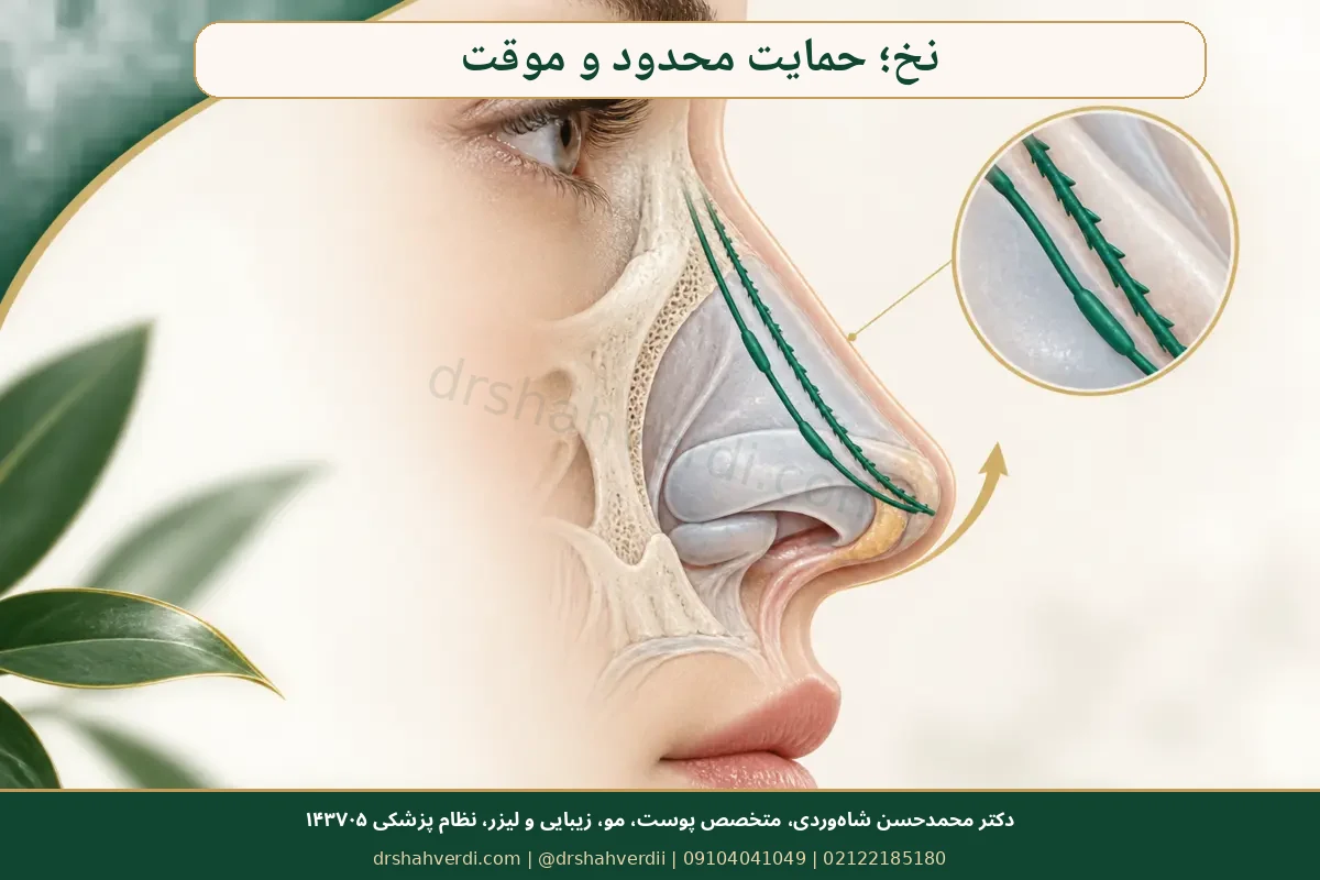 مکانیسم و محدودیت‌های لیفت بینی با نخ