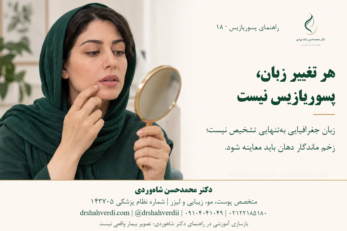 تصویر مفهومی بزرگسال در حال بررسی دهان با آینه، بدون نسبت دادن ضایعه دهانی به پسوریازیس