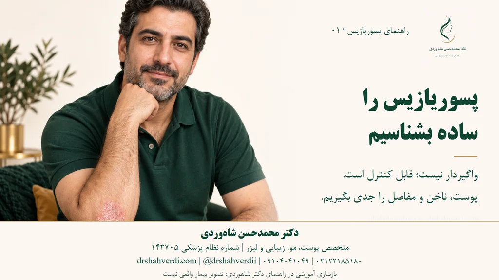 تصویر مقاله پسوریازیس چیست؟ علائم، انواع و درمان بیماری صدف