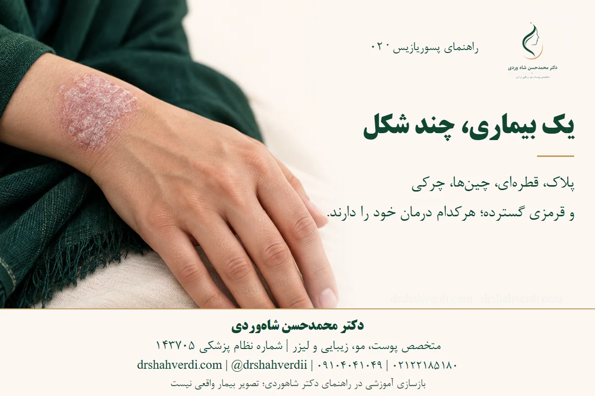 تصویر مفهومی پسوریازیس پوست و تغییرات ظریف ناخن در کنار خلاصه انواع بیماری