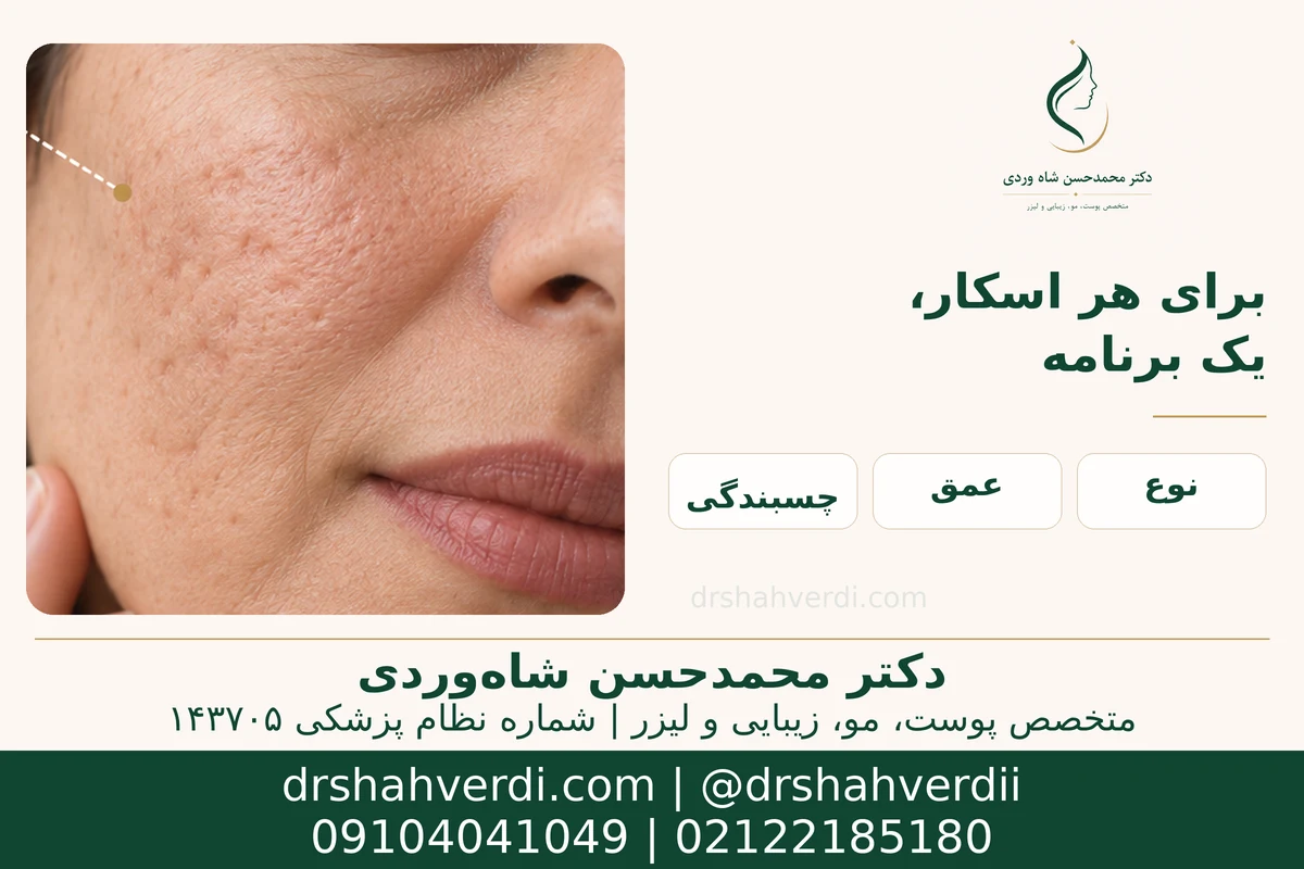 ارزیابی نوع اسکار آکنه پیش از انتخاب RF یا بازسازی سطح