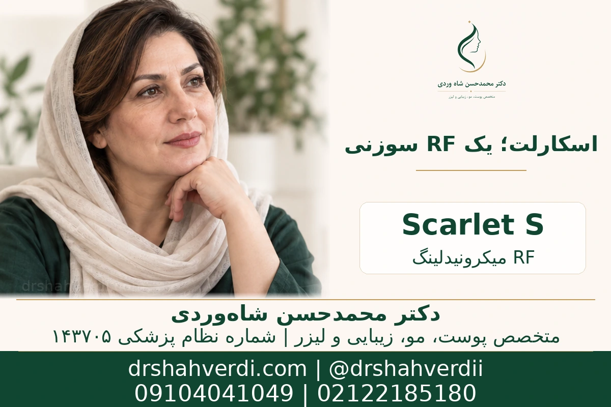 راهنمای شناخت اسکارلت S در خانواده RF میکرونیدلینگ