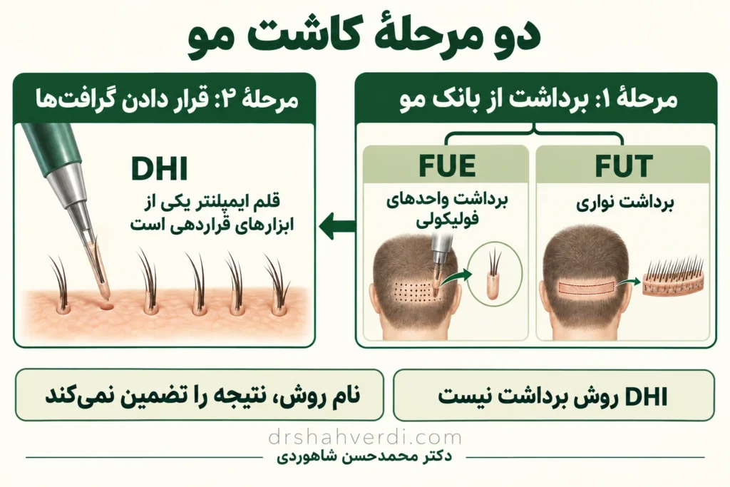 تصویر مقاله روش‌های کاشت مو؛ تفاوت FUT، FUE و DHI