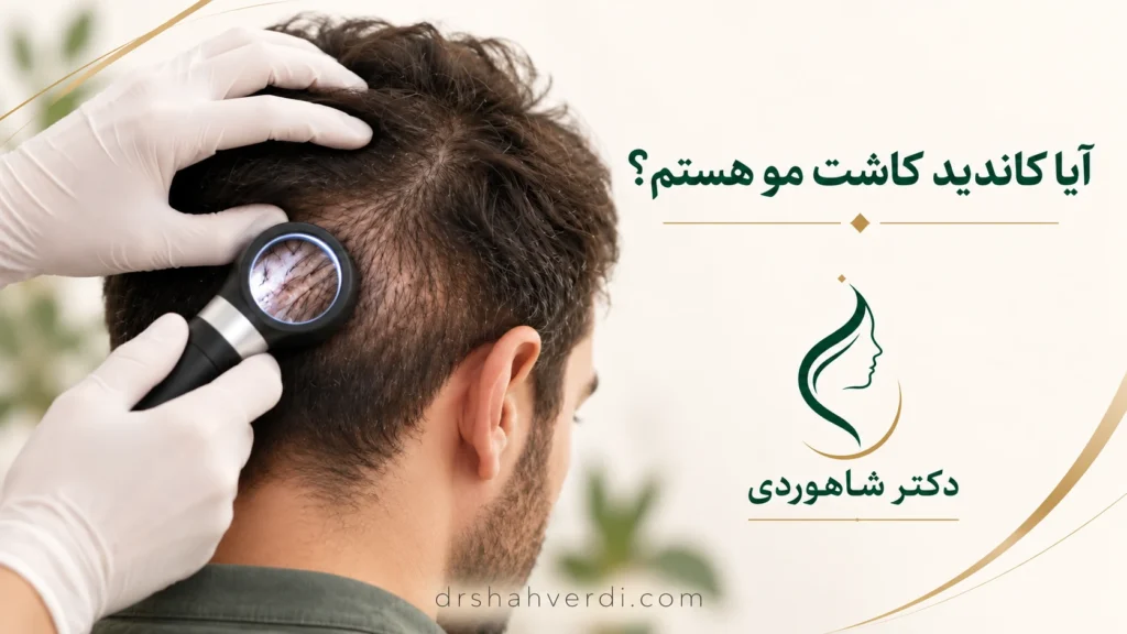 تصویر مقاله آیا کاندید کاشت مو هستم؟ ارزیابی بانک مو و محدودیت‌ها