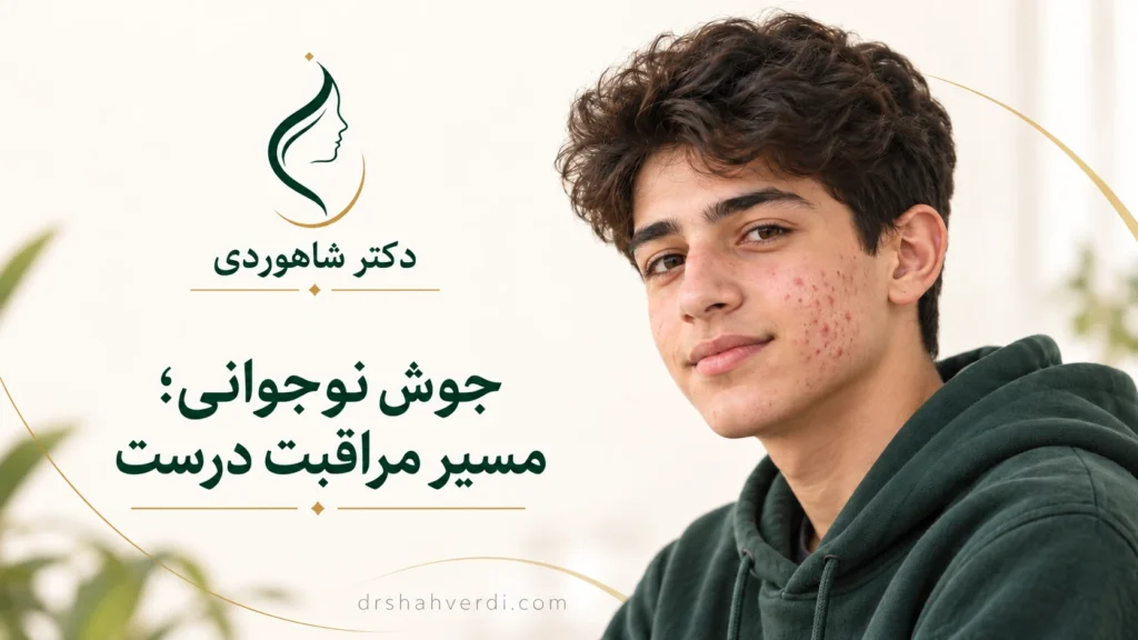 تصویر مقاله جوش بلوغ (آکنه نوجوانان) | درمان‌های به‌روز ۲۰۲۵ و پیشگیری | دکتر محمدحسن شاهوردی