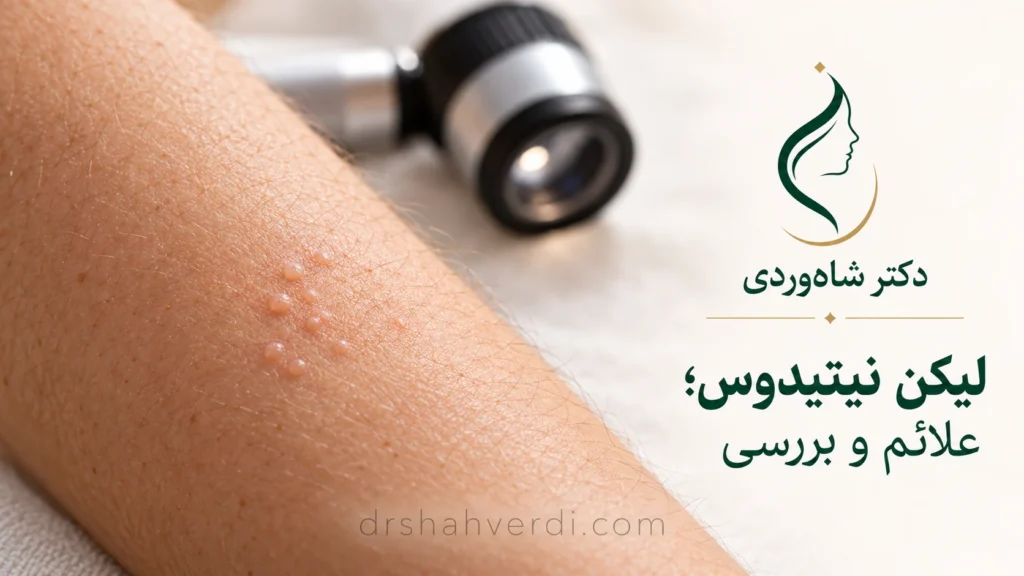 تصویر مقاله لیکن نیتیدوس (Lichen Nitidus) | علائم، تشخیص و درمان | دکتر محمدحسن شاهوردی