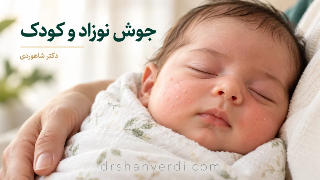 تصویر مقاله جوش نوزاد و کودک؛ تفاوت آکنه با دانه‌های دیگر و زمان معاینه