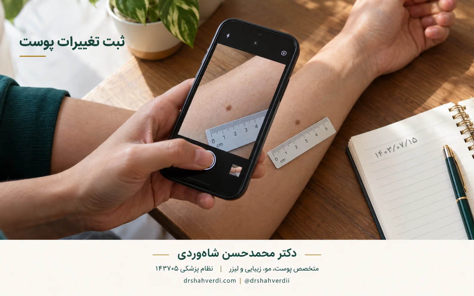 عکس‌گرفتن از پوست با خط‌کش برای مقایسه اندازه در زمان‌های مختلف