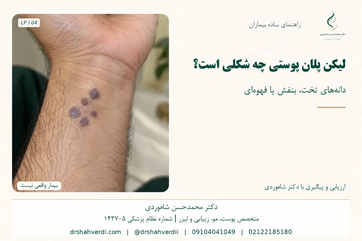 دانههای تخت بنفش روی مچ دست