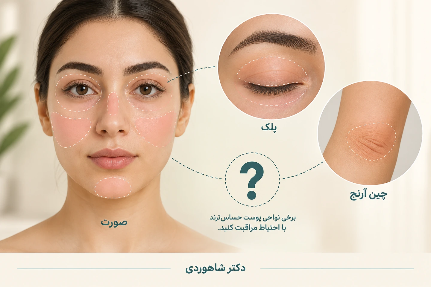 نمای صورت، پلک و چین آرنج در کنار علامت پرسش