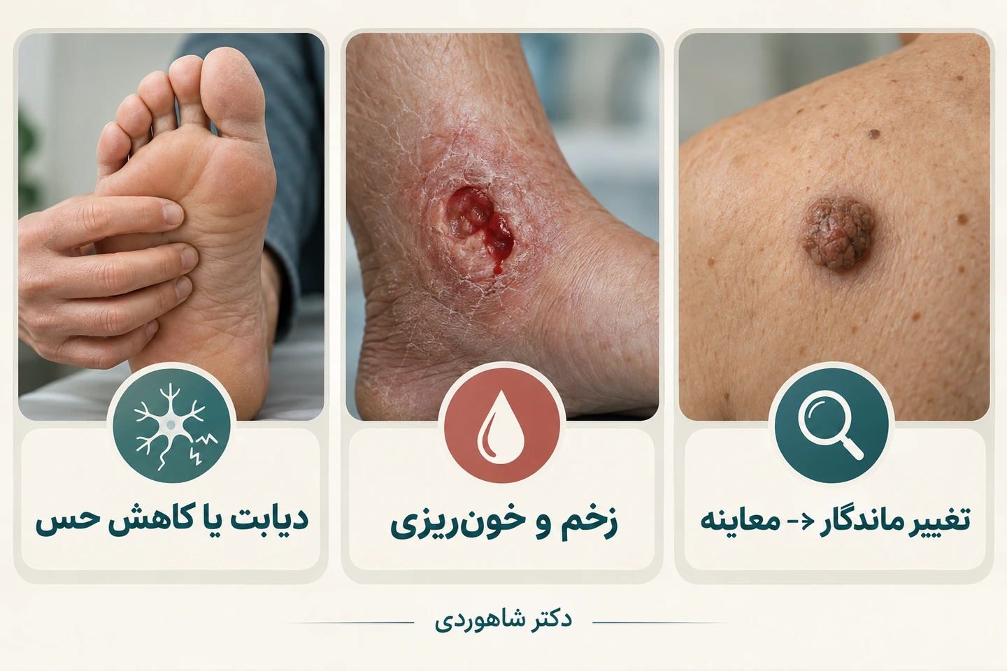 شرایط نیازمند احتیاط پیش از درمان میخچه