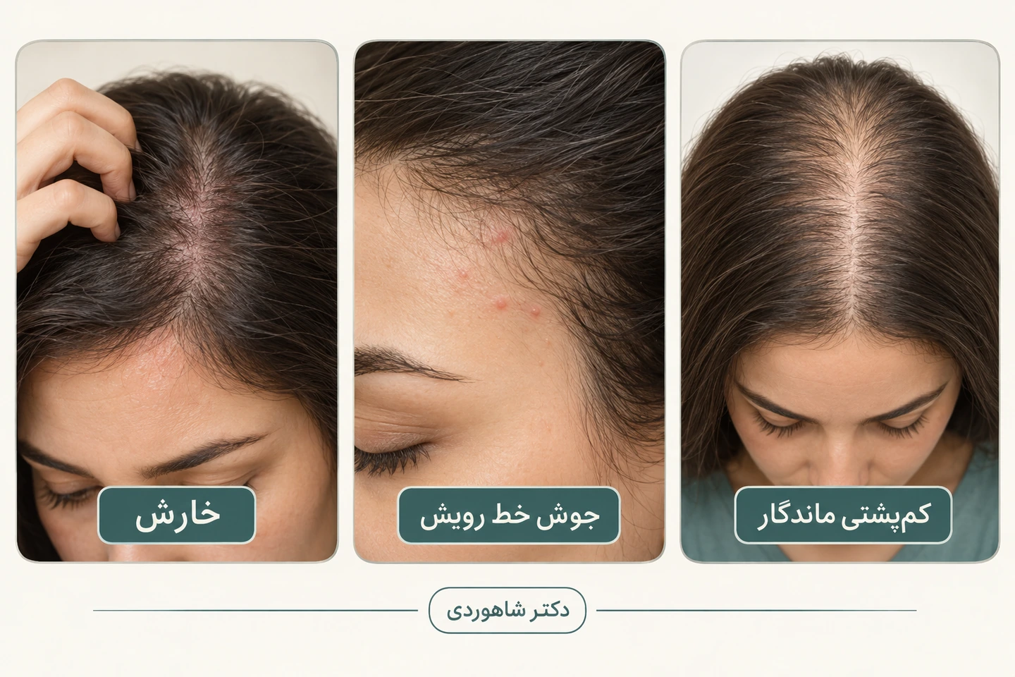 کارت خارش، جوش خط رویش و ریزش پایدار کنار دفتر ثبت