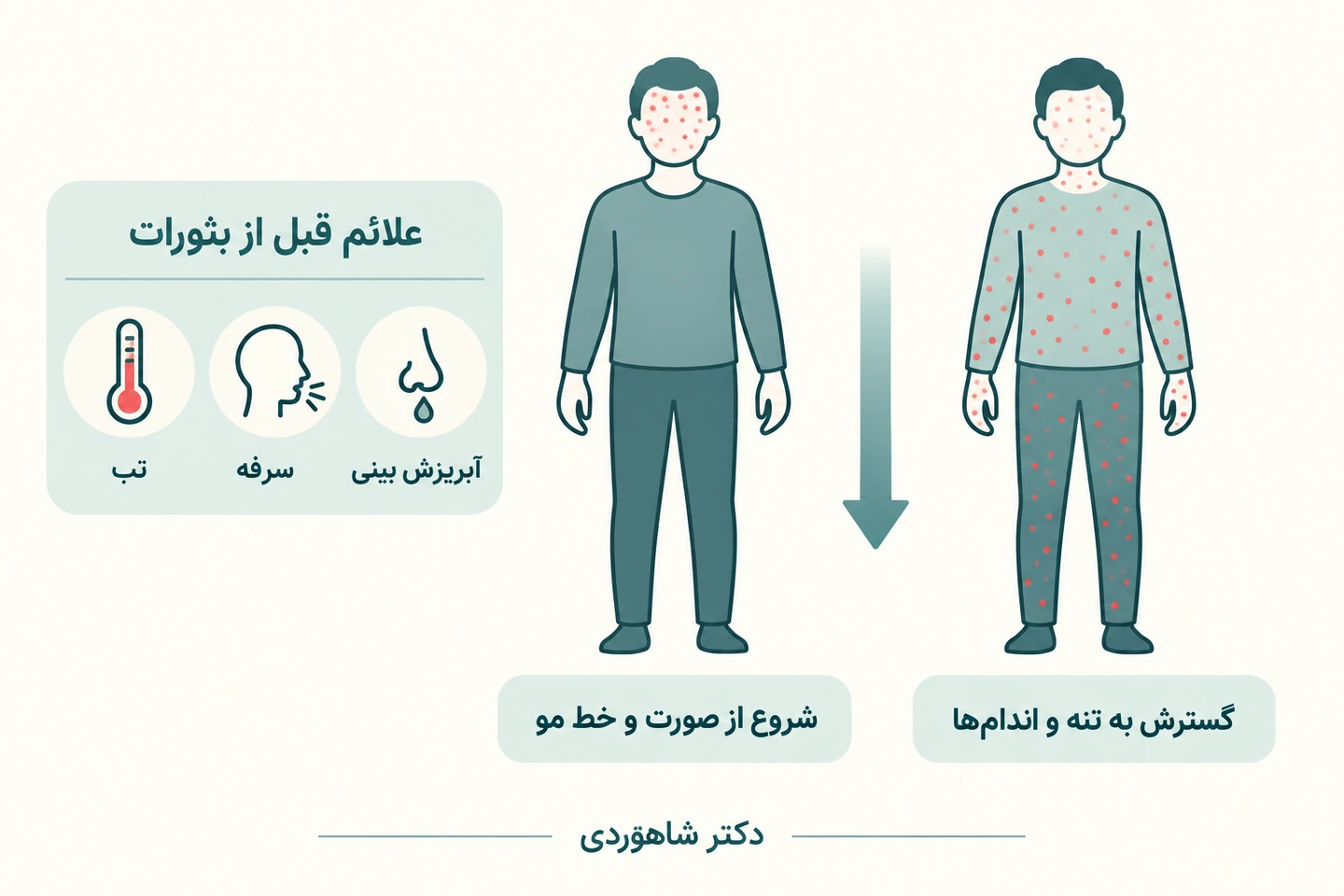 الگوی معمول گسترش راش از صورت به بدن