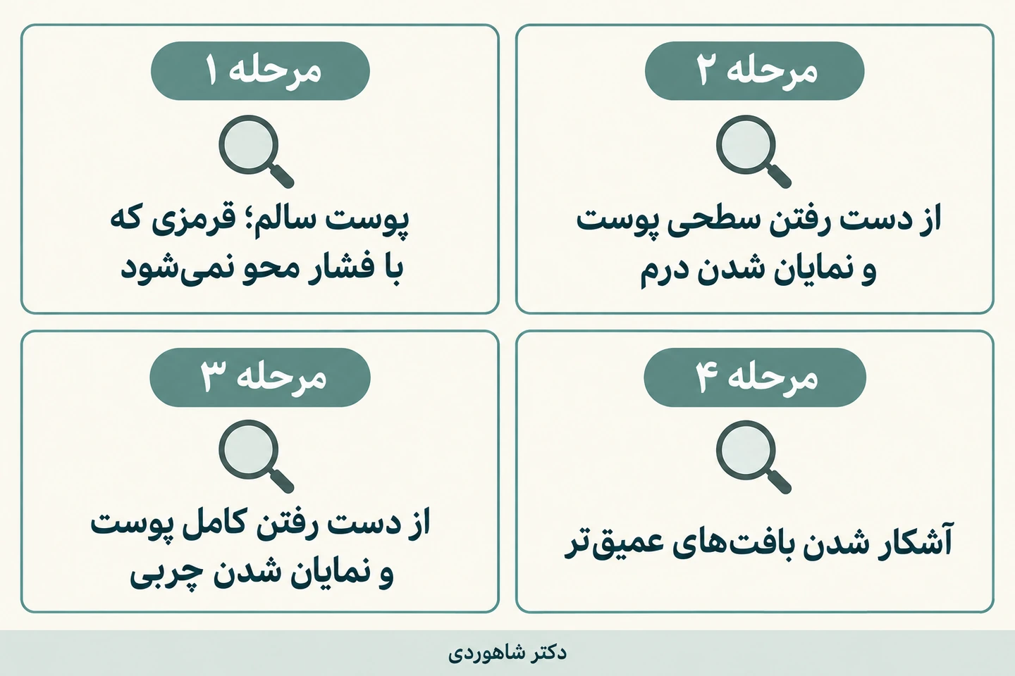 مقایسه تعریف مراحل یک تا چهار آسیب فشاری