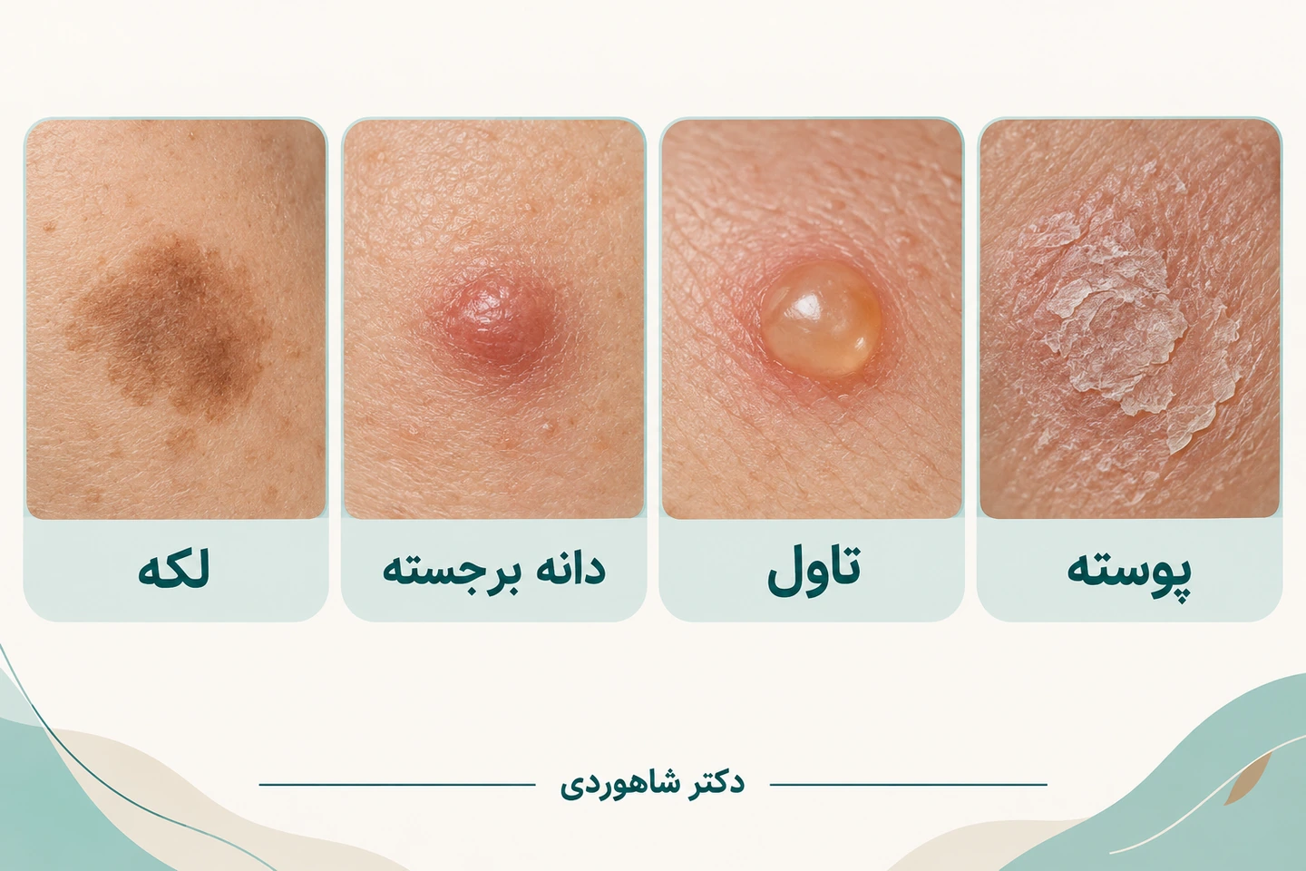 الگوهای لکه، برجستگی، تاول و پوسته