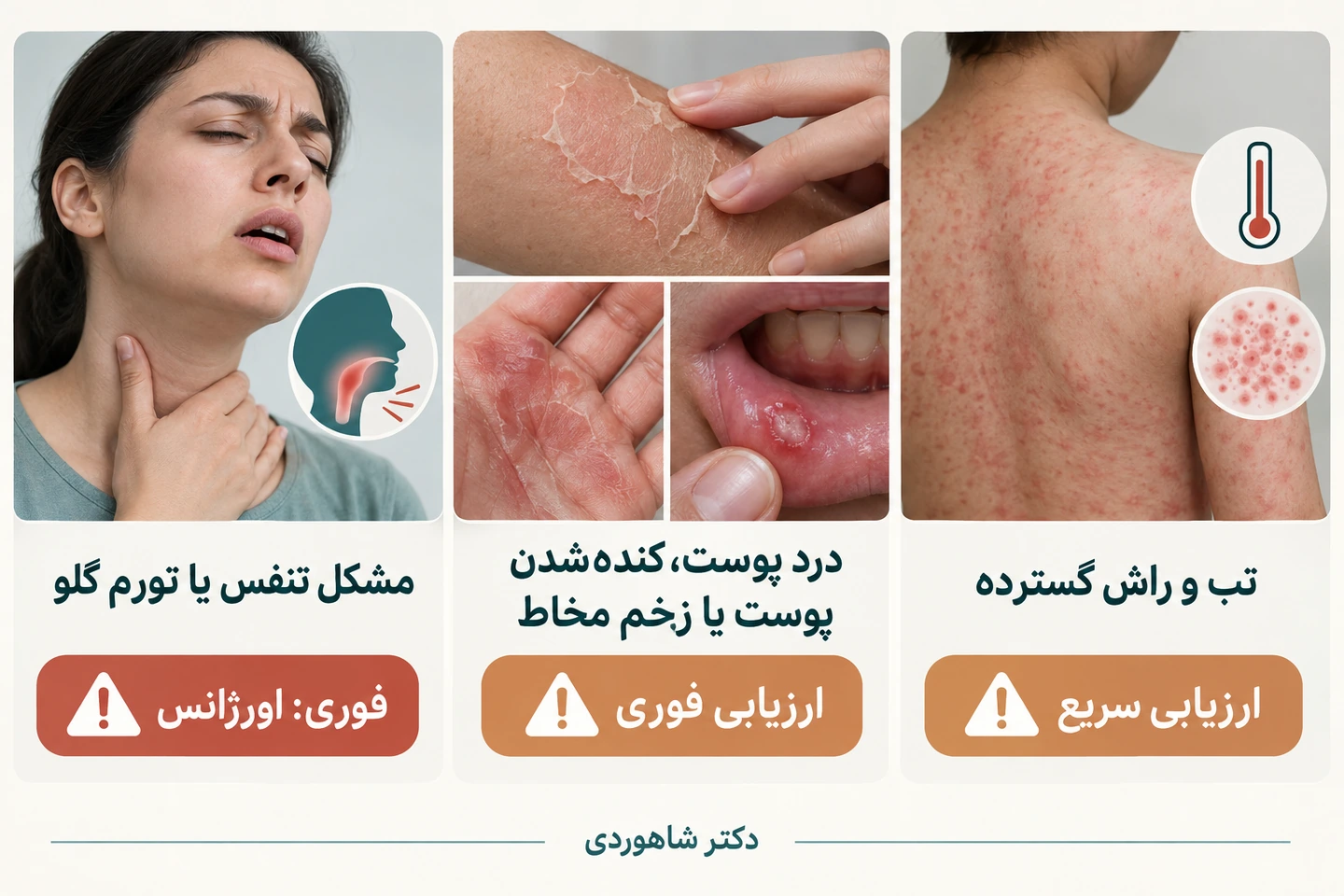 نشانه‌های خطر راش؛ تنفس، درد پوست و درگیری مخاط