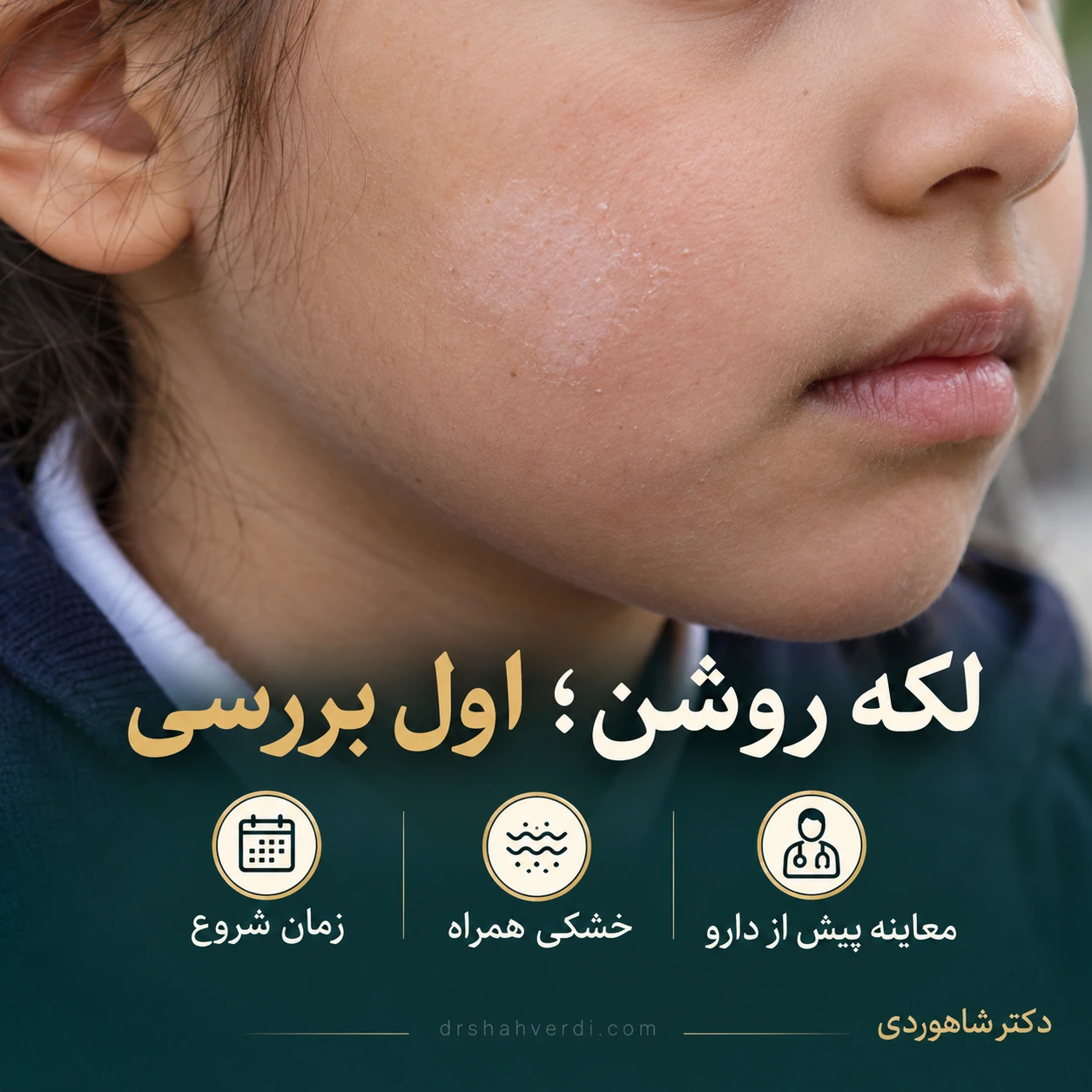 بخشی از گونه کودک با لکه کم‌رنگ دارای مرز محو و خشکی ظریف