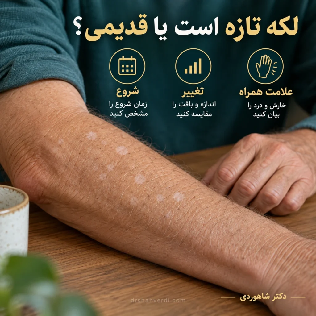 تصویر مقاله لکه‌های سفید ریز روی ساعد و ساق؛ هیپوملانوز گوتات چیست؟