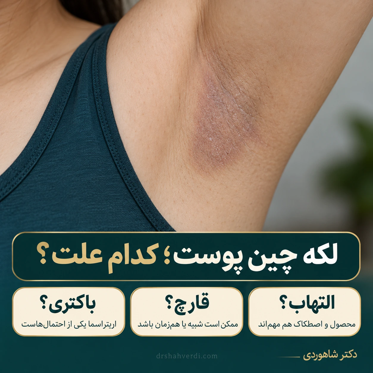 نمای نزدیک چین زیربغل بزرگسال با لکه صورتی‌قهوه‌ای و پوسته ظریف