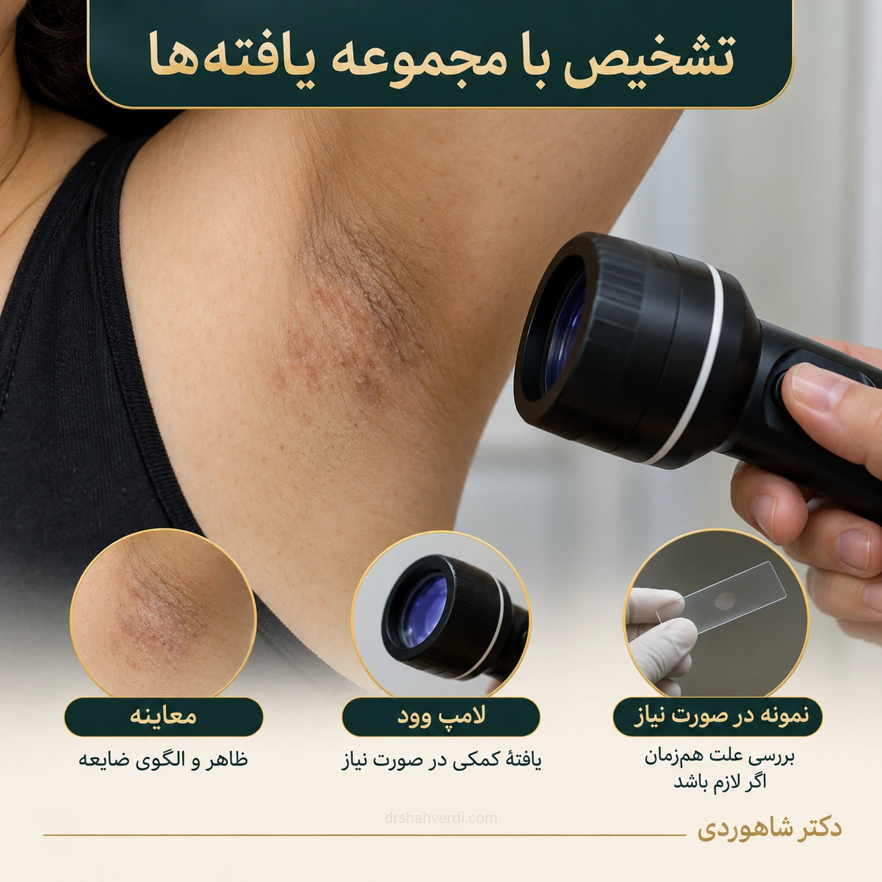 دست با لامپ وود نزدیک پوست چین زیربغل در فضای معاینه خنثی