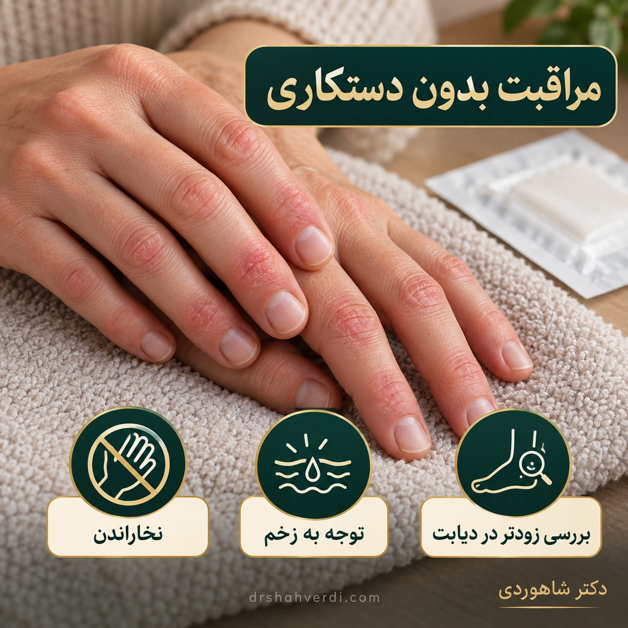 پوست تحریکشده را دستکاری نکنیم دستها در وضعیت استراحت با تغییر رنگ خفیف انگشت و حوله نرم کنار آن