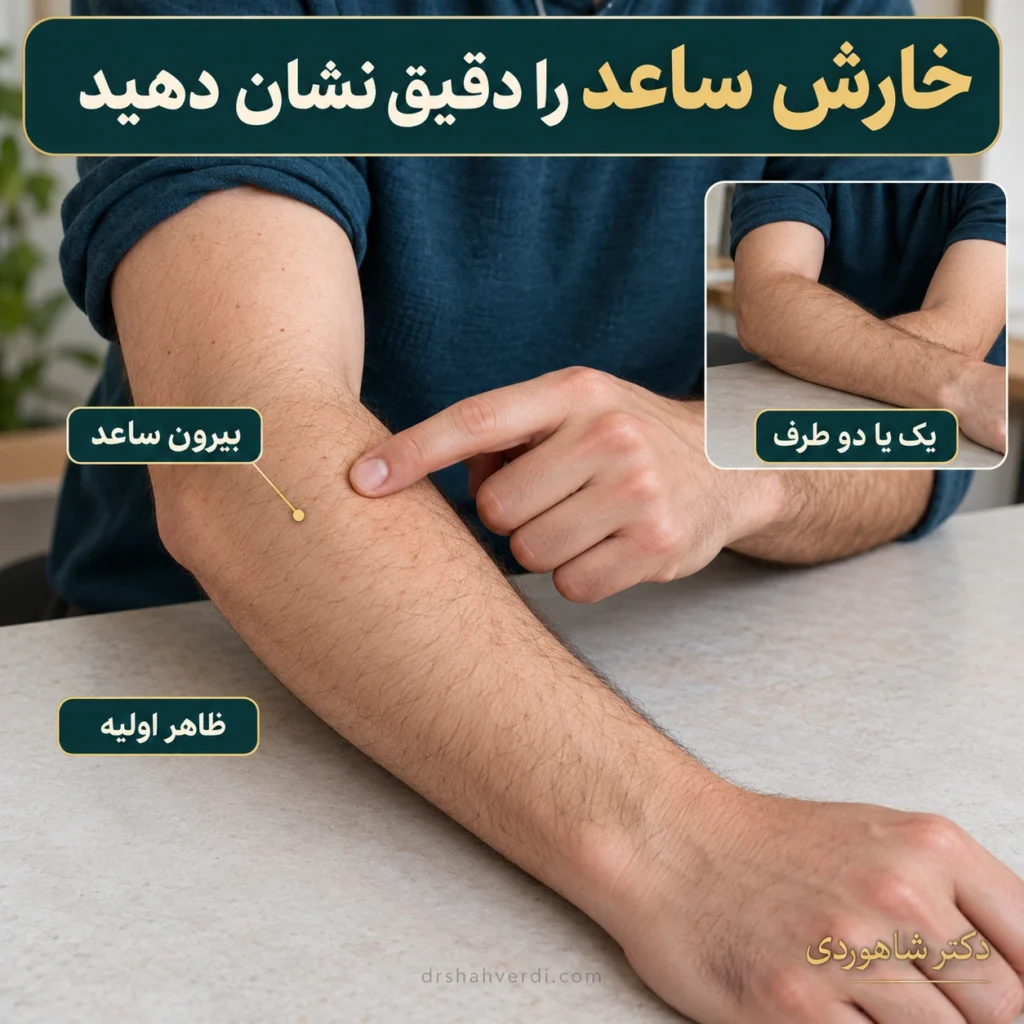تصویر مقاله خارش ساعد؛ خارش براکیورادیال و علت‌های قابل بررسی